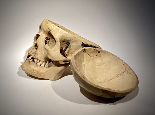 19th Century Medical Skull - Curiosities Style Napoléon III