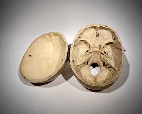 Curiosities  - 19th Century Medical Skull
